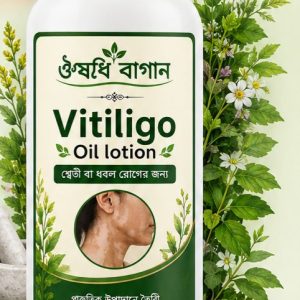 Vitiligo Oil lotion